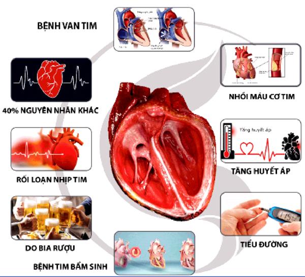 Hướng dẫn chẩn đoán và điều trị suy tim
